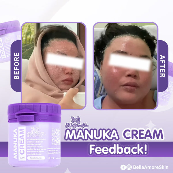 [Bella Amore Skin] Manuka Cream - Venice and Vica Beauty